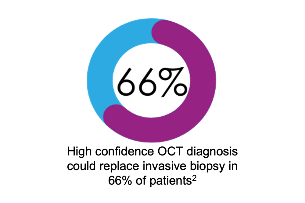 Studies show 66% of patients may be able to avoid invasive biopsy