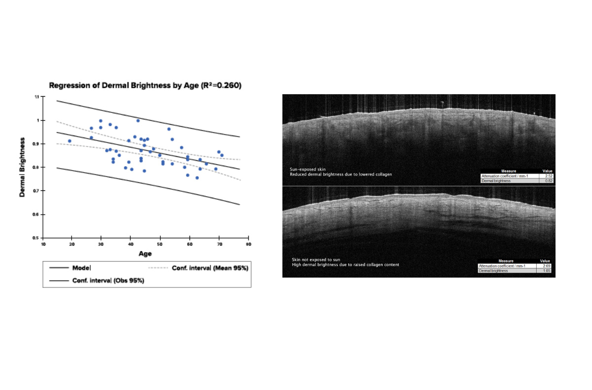 Dermal Brightness with age